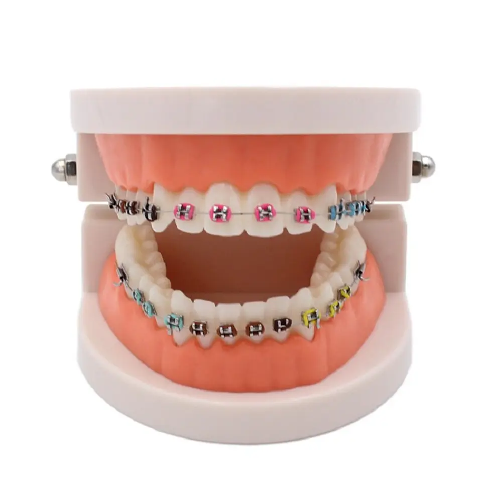 Arcada Modelo Dental Bracket Odontología Dientes Ortodoncia 1