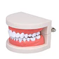 Arcada Modelo Dental Con Caries Odontología Dientes - Miniatura 2