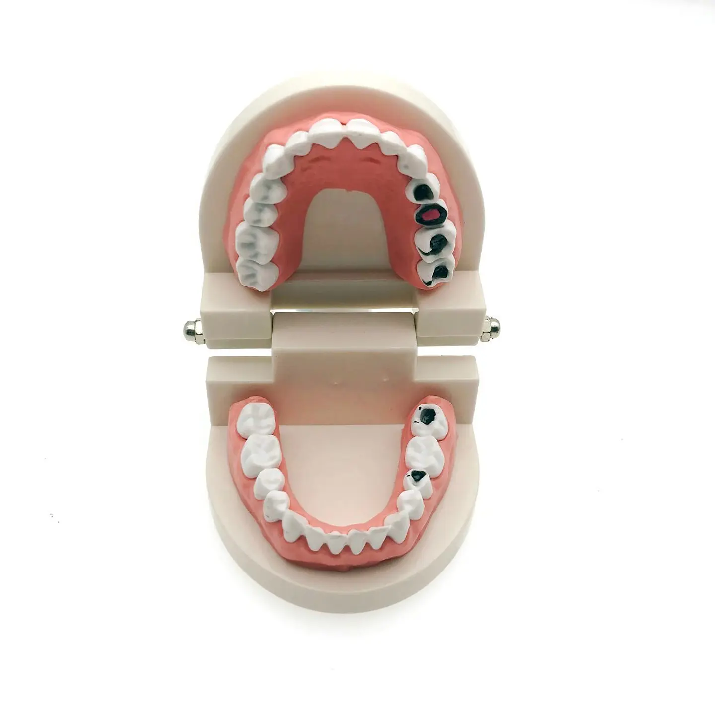 Arcada Modelo Dental Con Caries Odontología Dientes 1