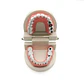 Arcada Modelo Dental Con Caries Odontología Dientes - Miniatura 1