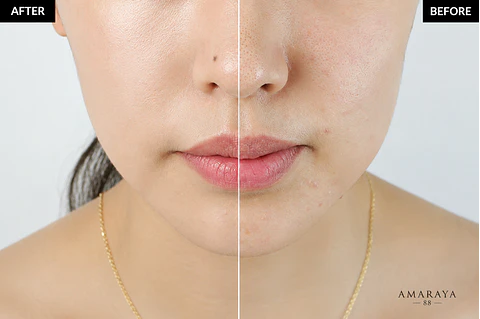 Klairs Illuminating Supple Blemish Cream