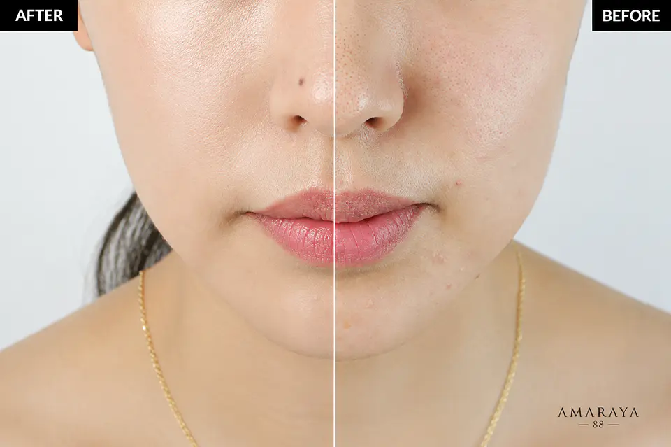 Klairs Illuminating Supple Blemish Cream 2