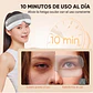 Masajeador Inteligente de Ojos con Calor, Bluetooth y Diseño Portátil - Miniatura 4