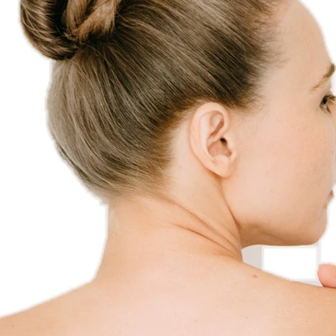 Depilación láser Cuello posterior