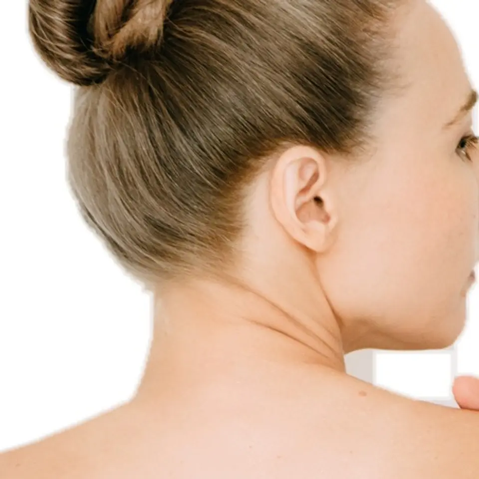 Depilación láser Cuello posterior 1