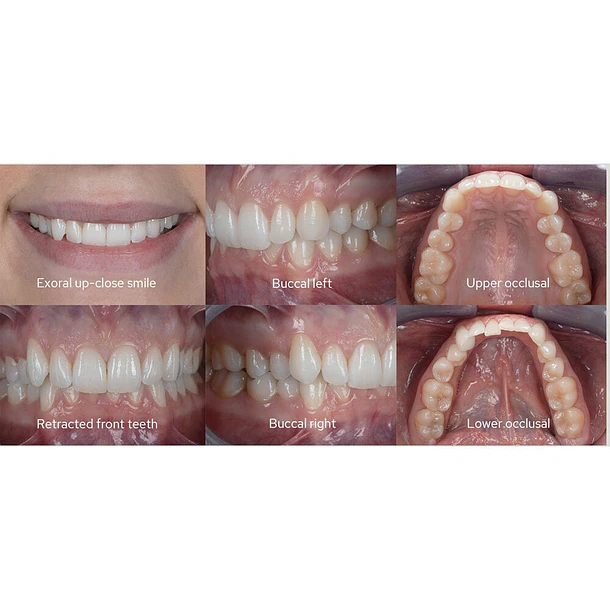 Godox MF12-DK1 Flash Macro Dental Para Dentistas Compatible Con Cámaras Sony 11