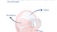 BOMBA SINGLE STIMOLATE CHICCO - Thumbnail 3