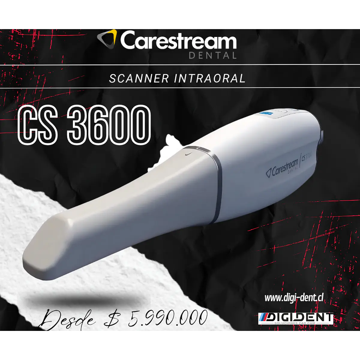 SCANNER INTRAORAL