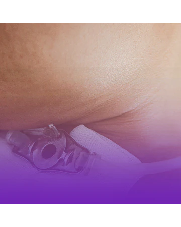 Atención Integral de enfermería al Paciente con Traqueostomía / 60 Hrs
