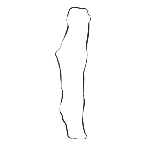 Empaquetadura Tapa Válvula Placa Peugeot 307 1.6cc 2002-2009 3