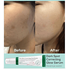 DARK SPOT CORRECTING GLOW SERUM de AXIS-Y