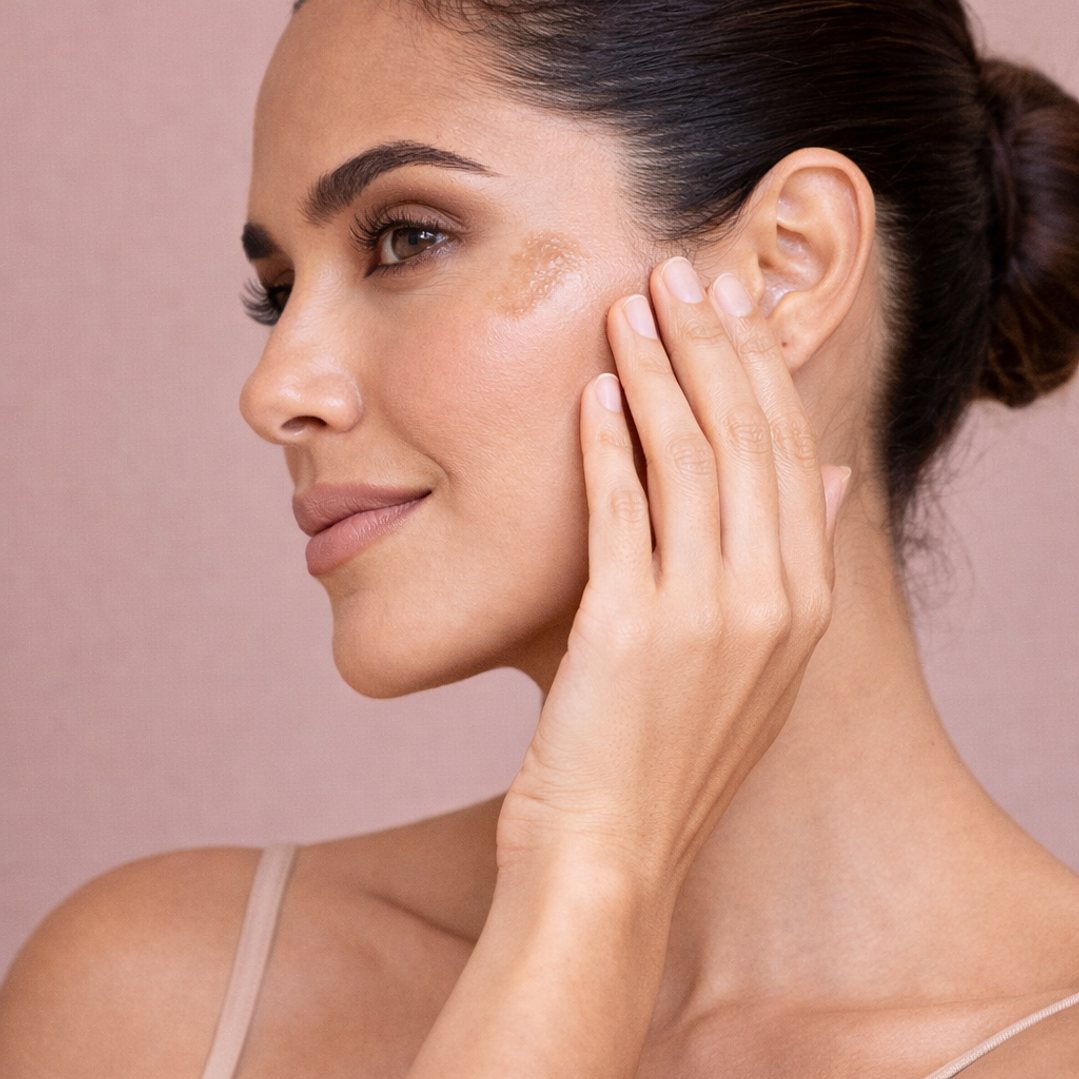 Adios a las Manchas 2