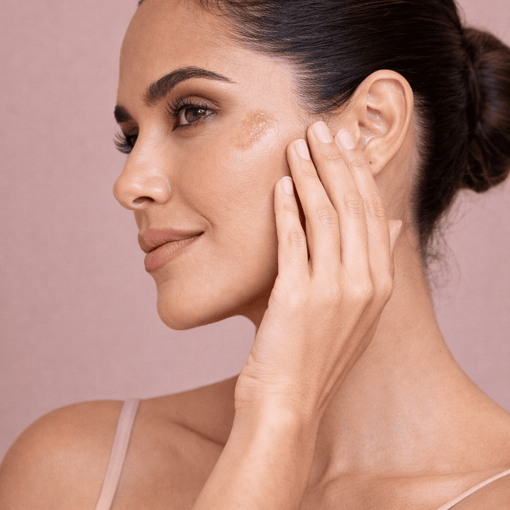 Adios a las Manchas 2