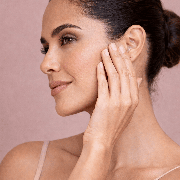 Adios a las Manchas 3