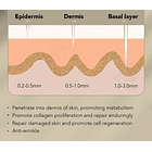 DERMAROLLER  Eliminación de Arrugas y Acné 5