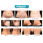 Equipo 6 en 1 - Lipoláser, Rf, Cavitación, Multipolar, Vacío y Más 6