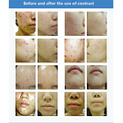 Cabina para Fototerapia Facial 7 Colores 5