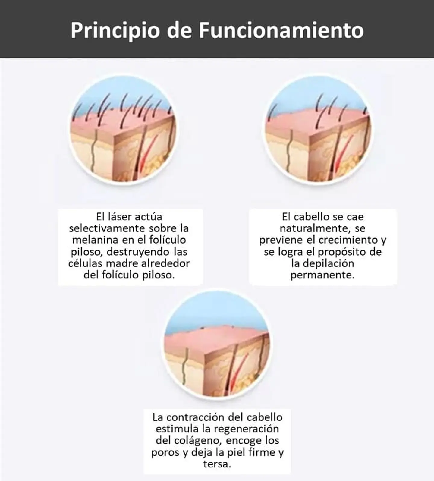 Equipo Triláser para Depilación Definitiva - 20 millones de Tiros 6
