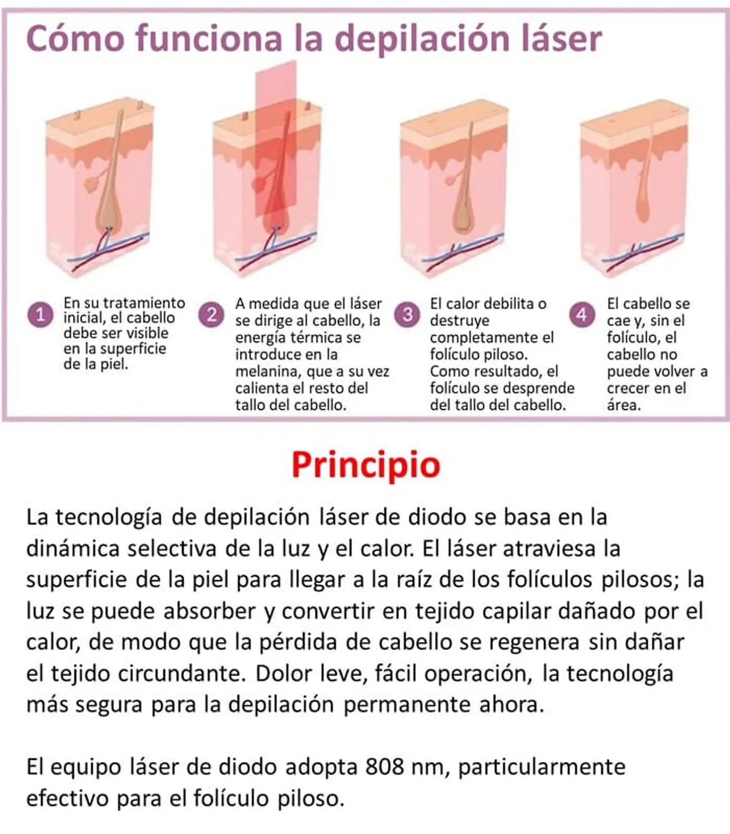 Equipo Triláser para Depilación Definitiva - 20 millones de Tiros 7