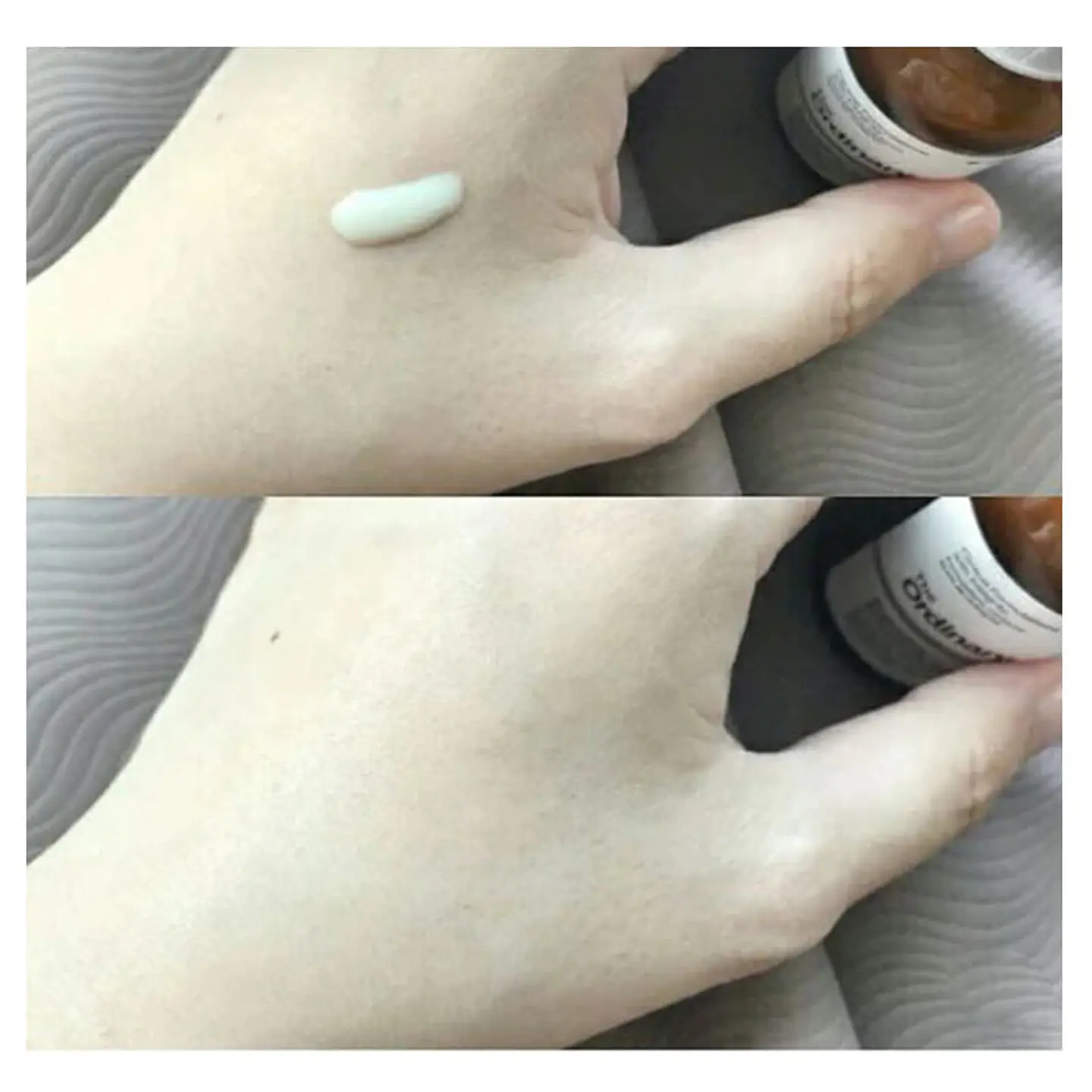  Suero de Retinoide al 2% 6