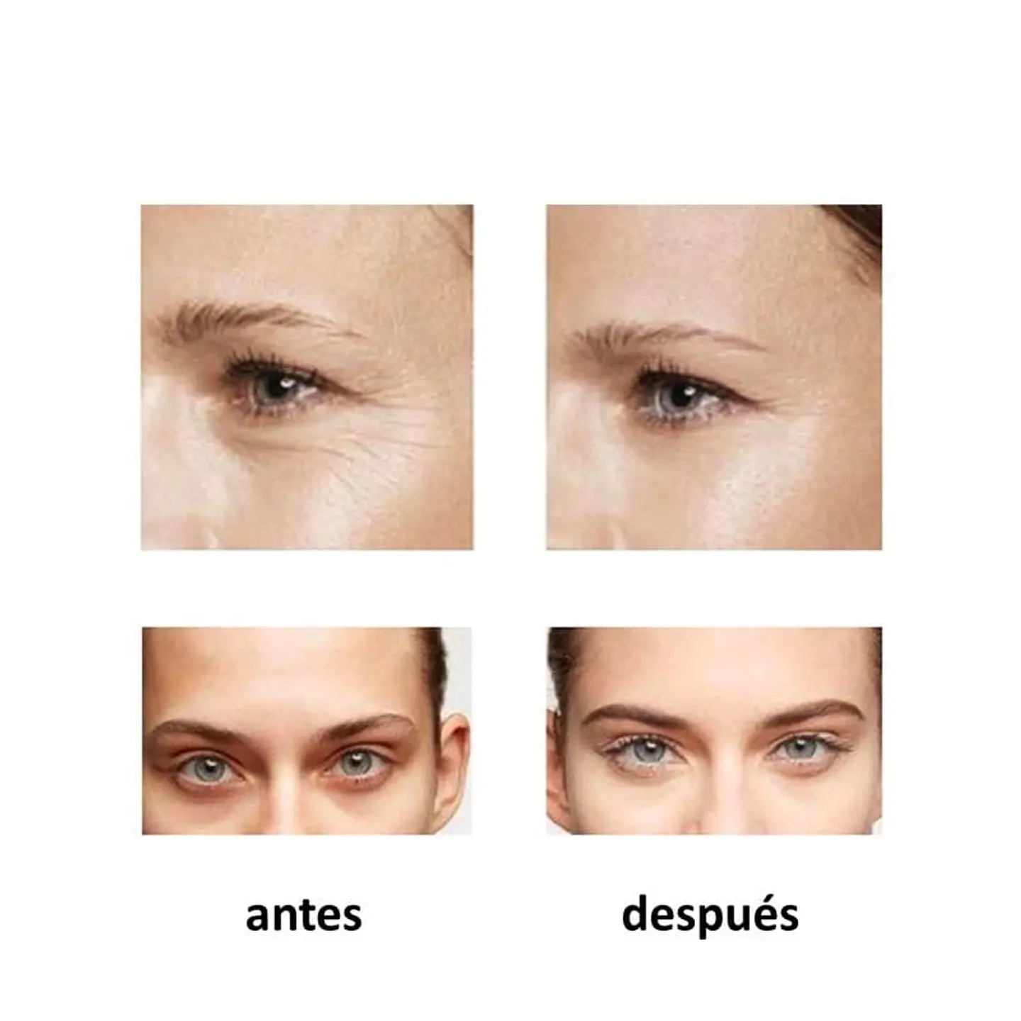 Cafeína en Suero al 5% 6