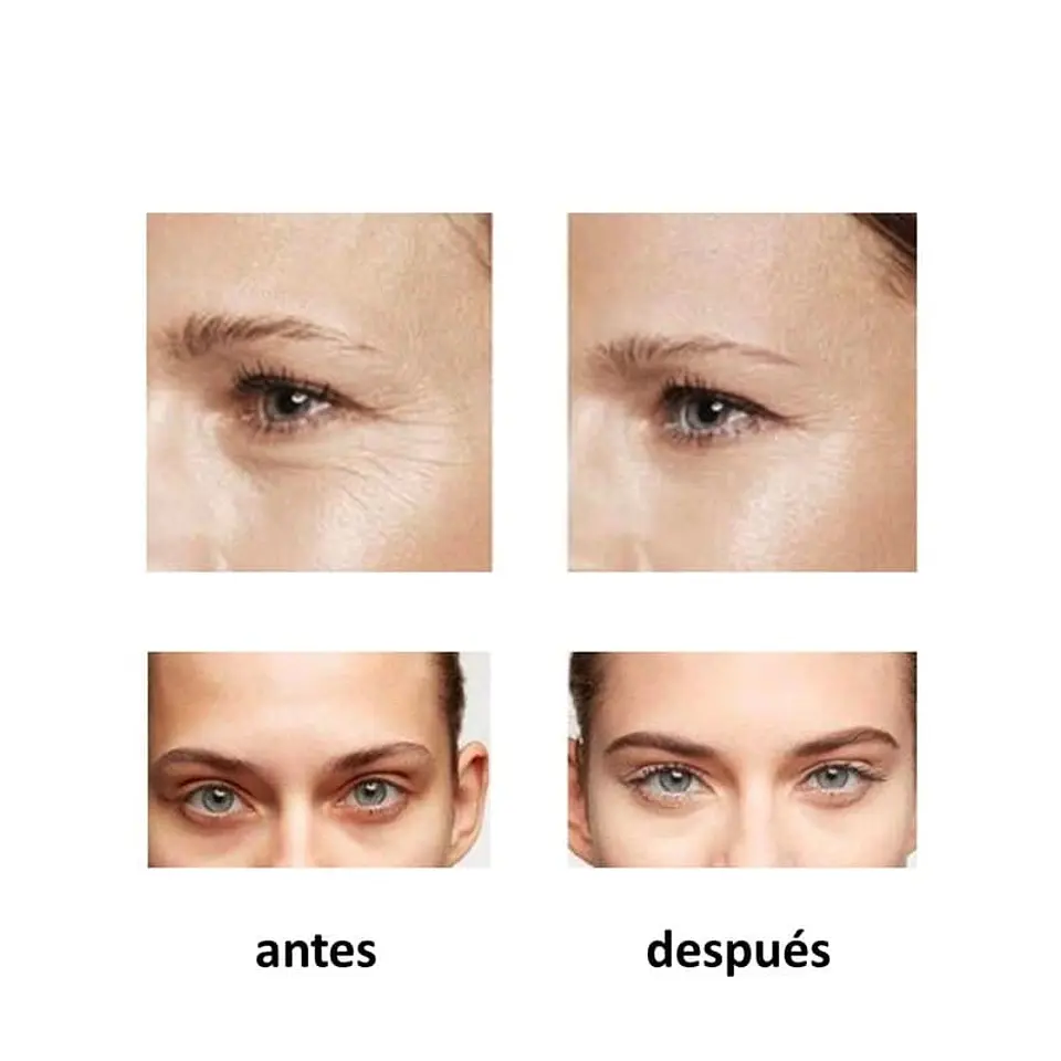 Cafeína en Suero al 5% 6