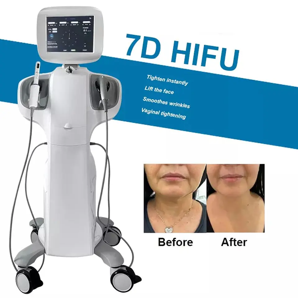HIFU 7D Vaginal - PRO 5