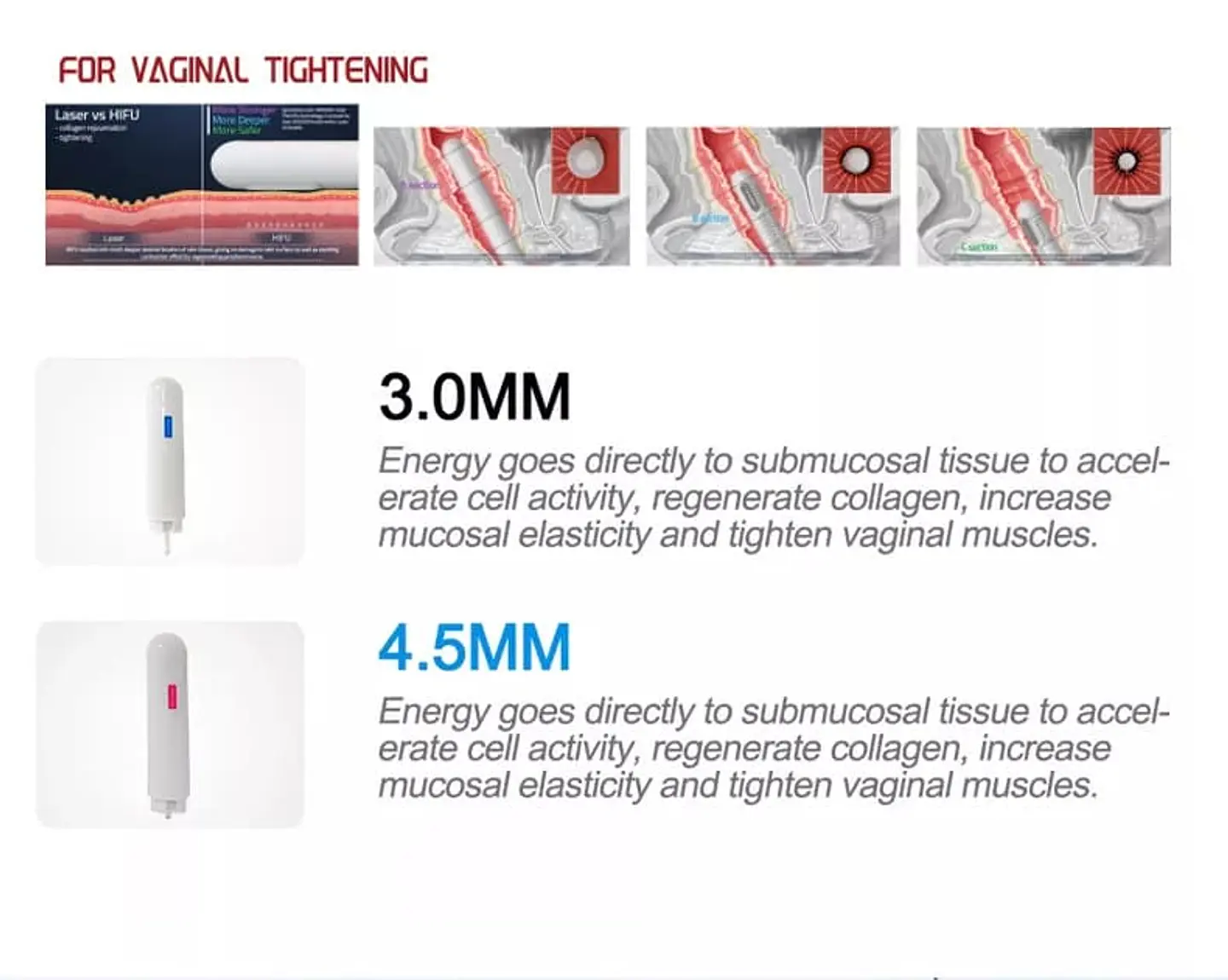 HIFU 7D Vaginal - PRO 10
