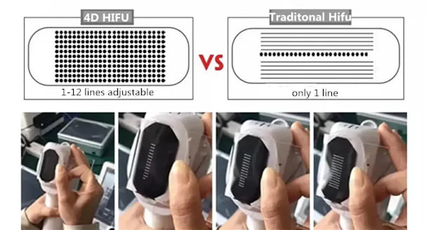 HIFU 4D 5en1 (Hifu 4D+Hifu Vaginal+Liposonix+Vmax+RF fraccionada) 4