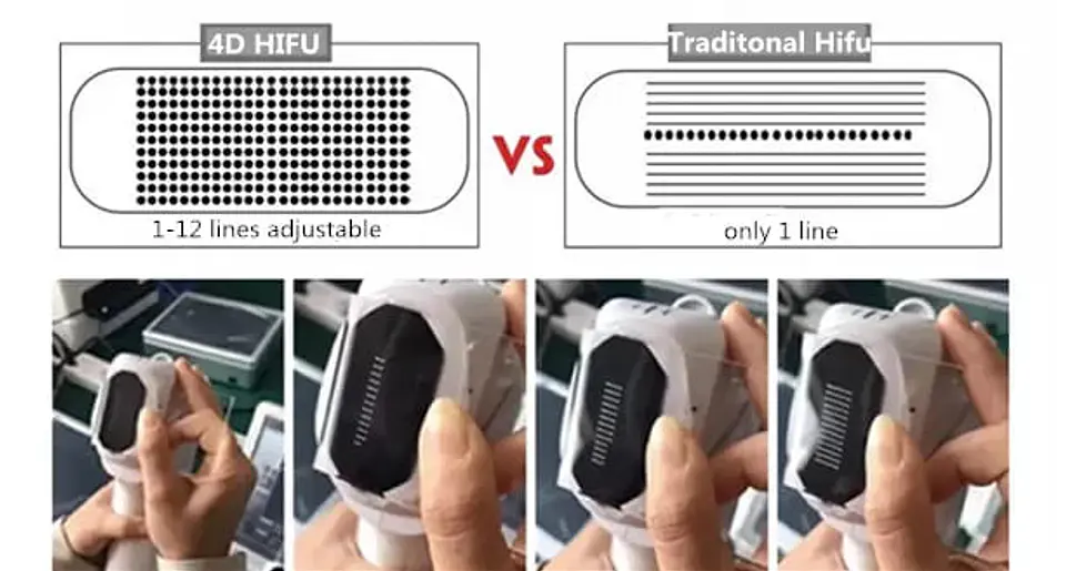 HIFU 4D 5en1 (Hifu 4D+Hifu Vaginal+Liposonix+Vmax+RF fraccionada) 4