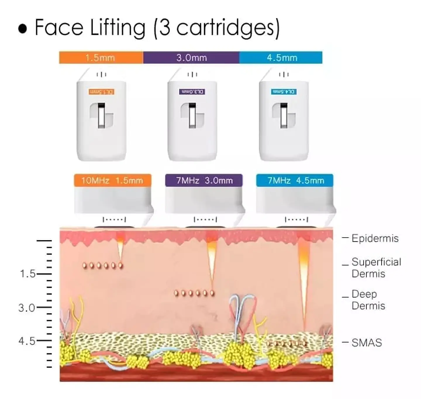 HIFU 4D 5en1 (Hifu 4D+Hifu Vaginal+Liposonix+Vmax+RF fraccionada) 5