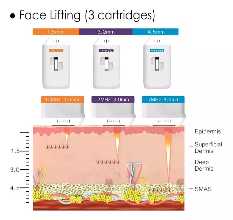 HIFU 4D 5en1 (Hifu 4D+Hifu Vaginal+Liposonix+Vmax+RF fraccionada) 5