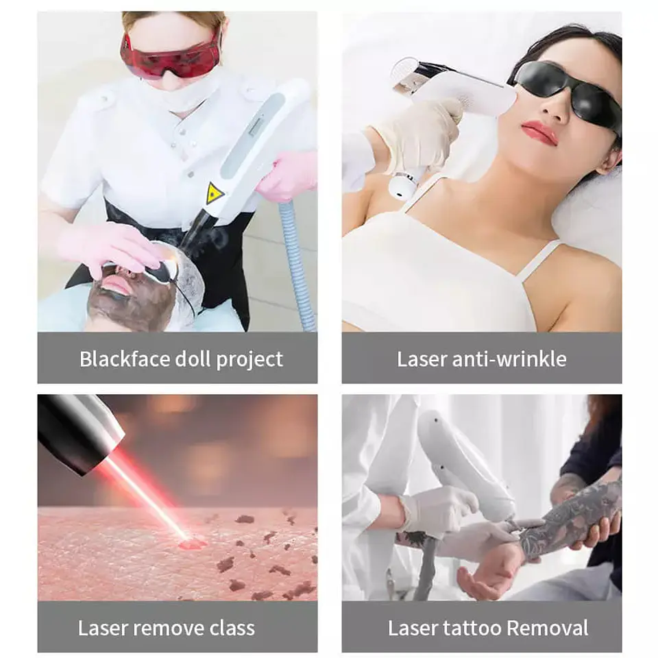 Extractor de Humos Negros de Tratamientos de Belleza 4