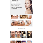 Equipo RF Monopolar/ Diatermia  RET y CET 448K  5