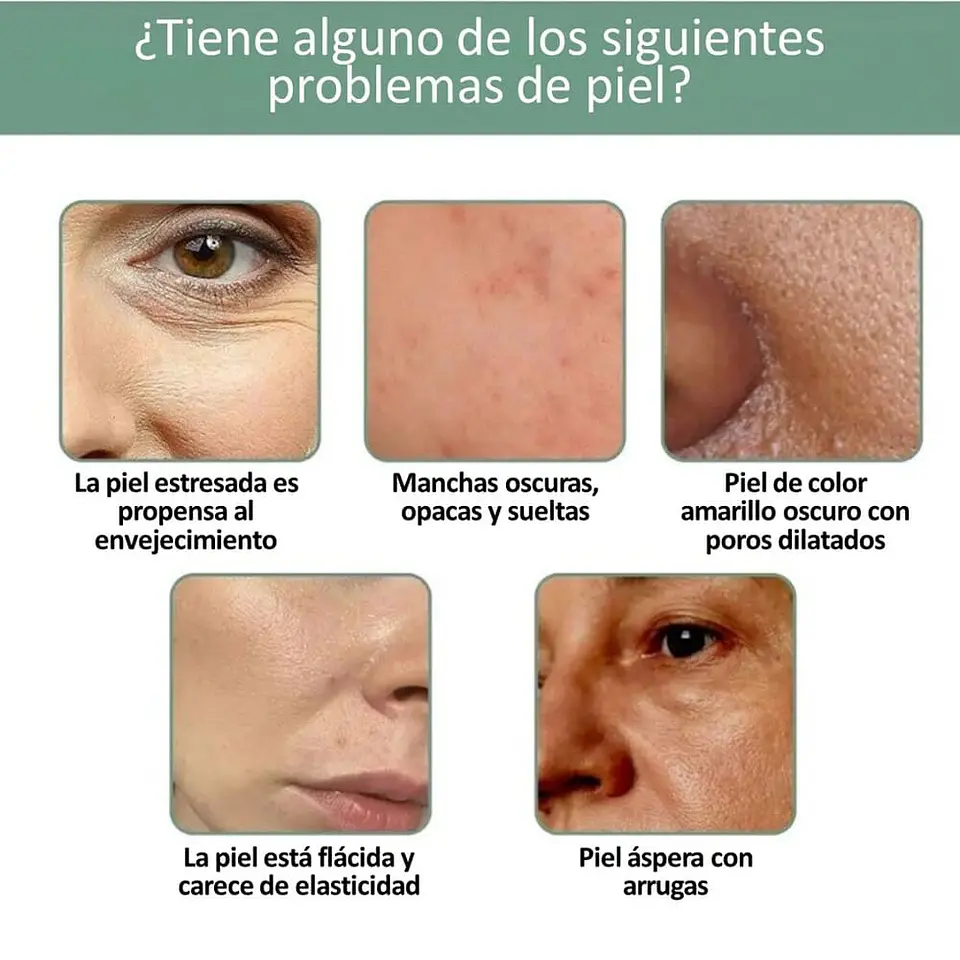 Serum de Colágeno 5