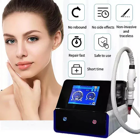 Equipo Picosegundo para eliminacion de Tatuajes, Peeling Hollywood y otros