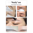 Equipo Picosegundo para eliminacion de Tatuajes, Peeling Hollywood y otros 8