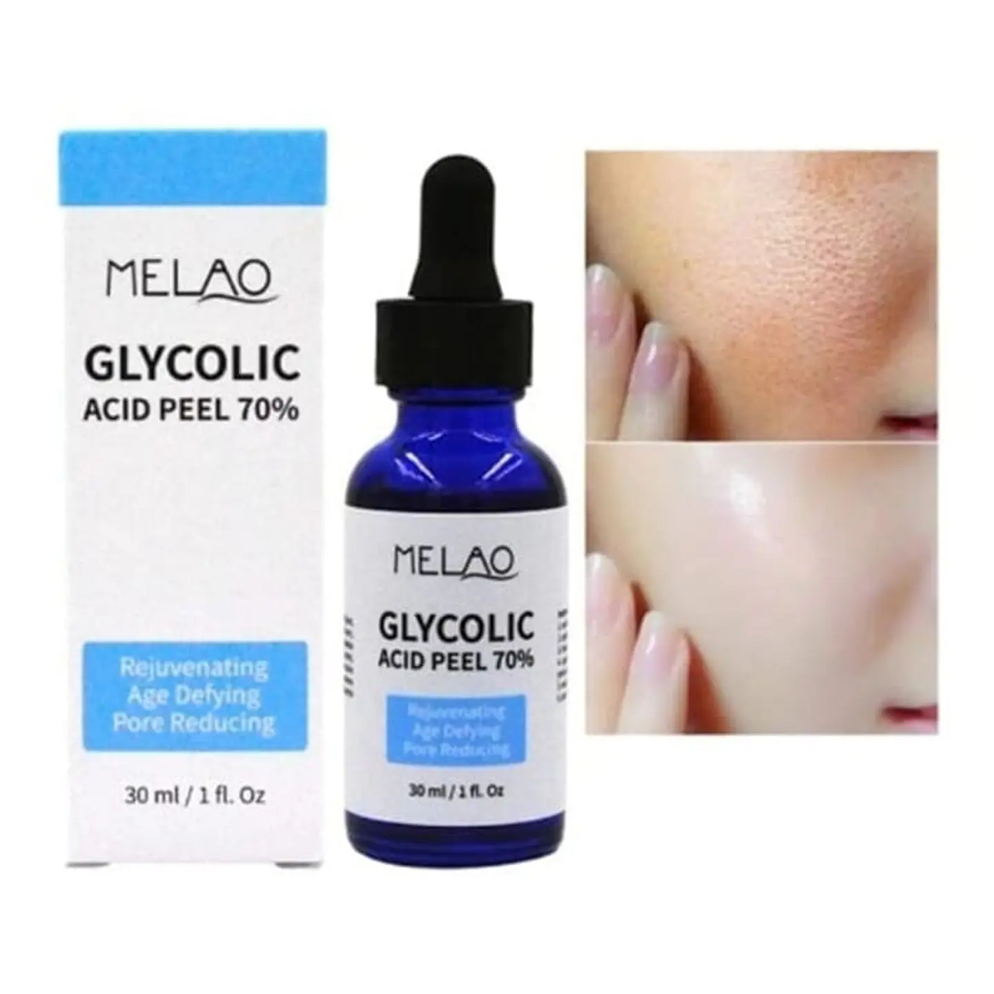 Serum de Ácido Glicólico 4