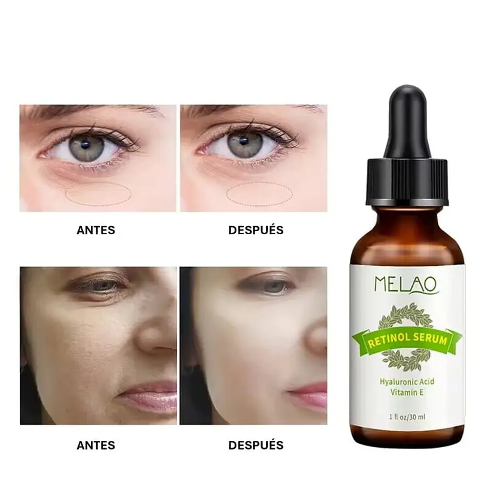 Serum de Retinol 5