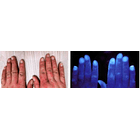 Luz / Lámpara de WOOD 2