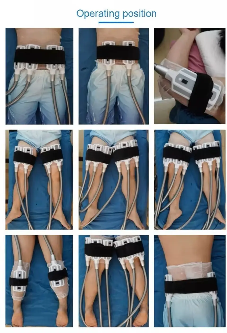 Criolipolisis PLANA 8 ASAS 8