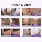 Cavitadora _cuerpo y rostro (NUEVO EQUIPO MULTIFUNCIONAL 4 EN 1) 3