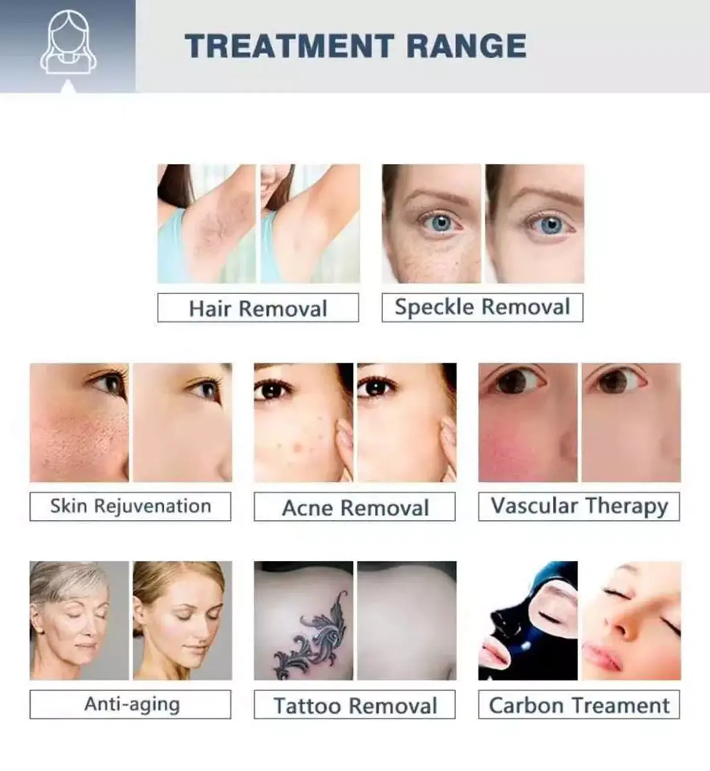 Equipo MULTIFUNCIONAL  OPT SHR - ELIGHT - RF - ND YAG 10