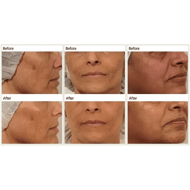 Oxy Co2 Bubble - 3 en 1 3