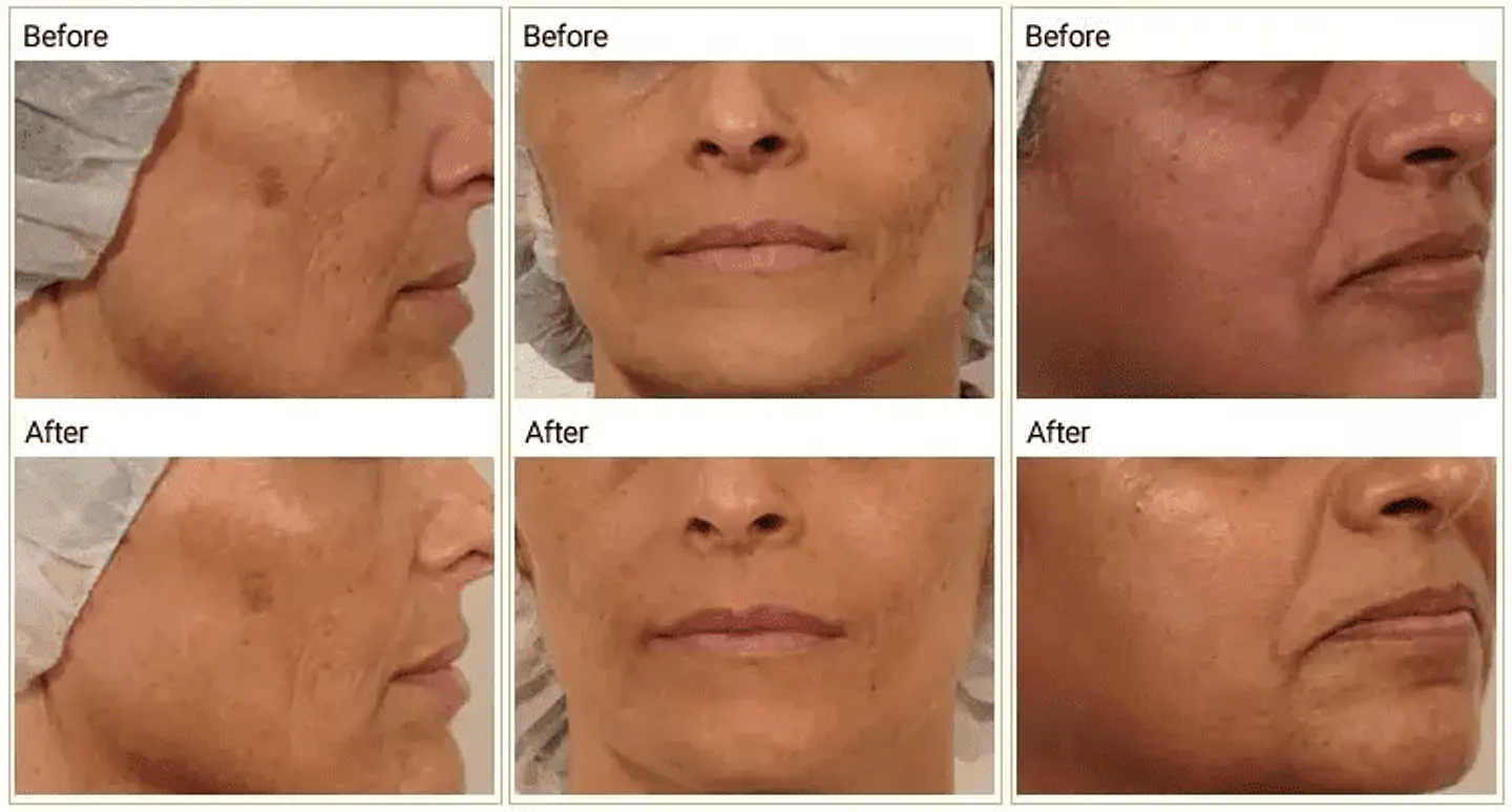 Oxy Co2 Bubble - 3 en 1 3