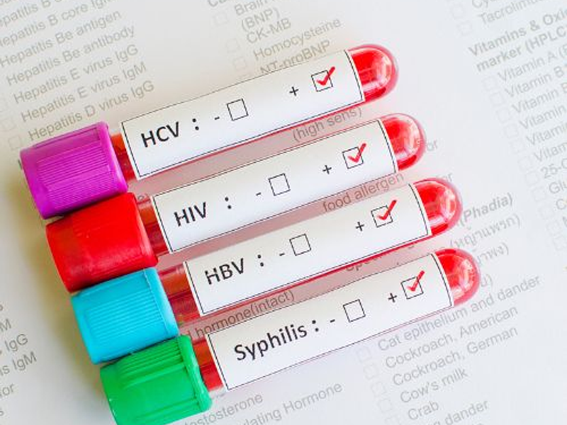 Cómo Prevenir y Tratar las Infecciones de Transmisión Sexual (ITS)