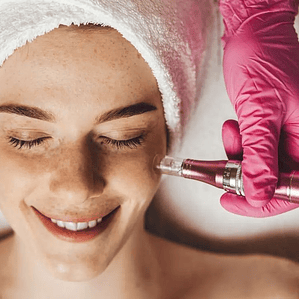 Mega cóctel de vitaminas con Dermapen