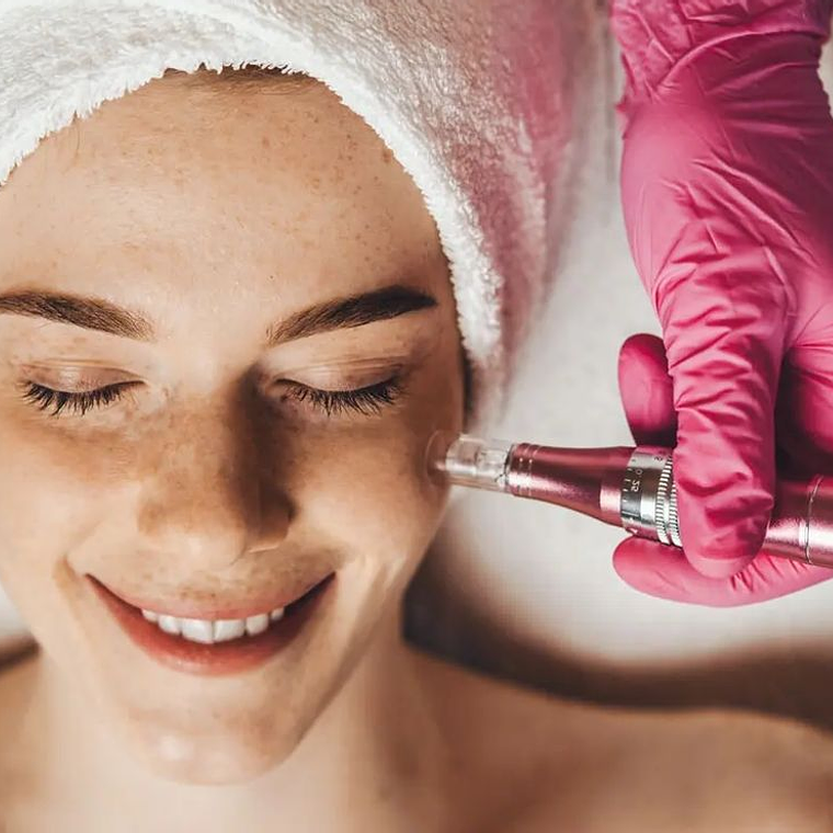 Mega cóctel de vitaminas con Dermapen 1