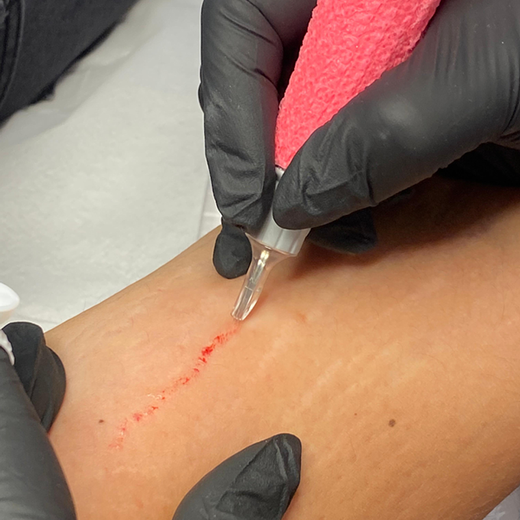 Camuflaje de estrías 2