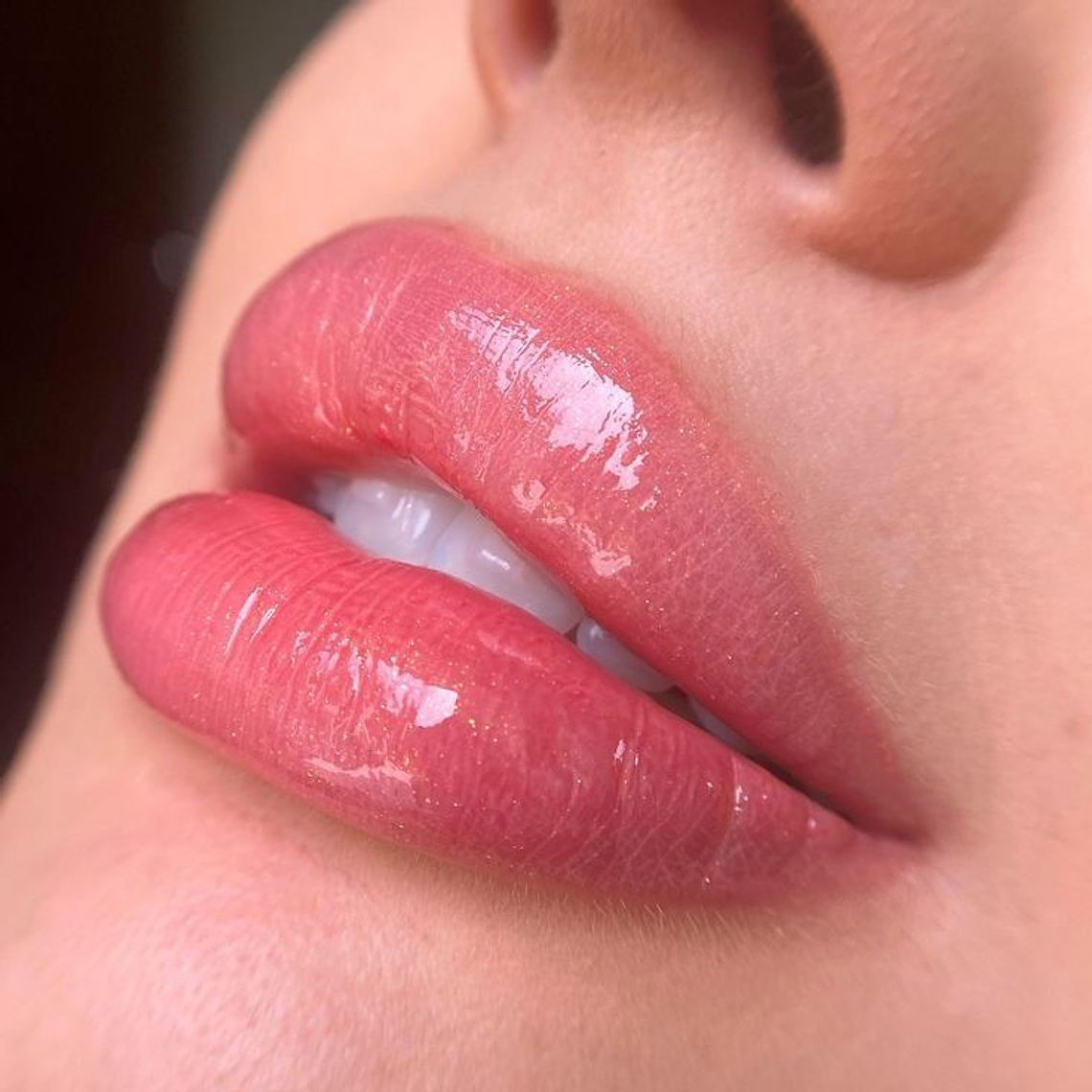 Hidragloss Lips 1